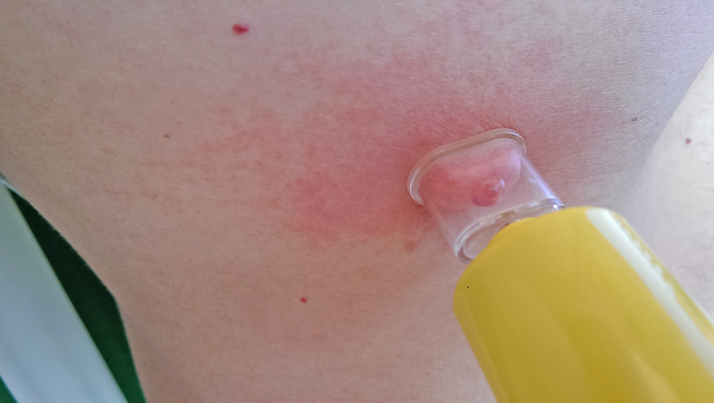 Sawyer The Extractor Pump Kit Extractor 7