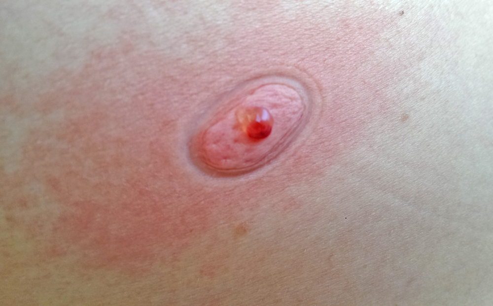 Sawyer The Extractor Pump Kit Extractor 8