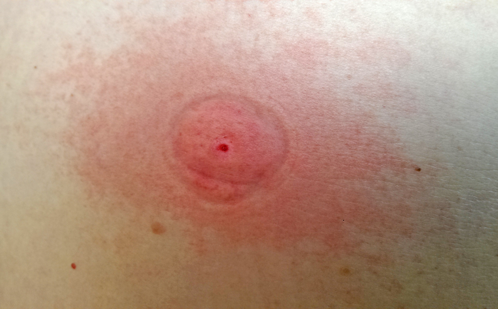 Sawyer The Extractor Pump Kit Extractor 9