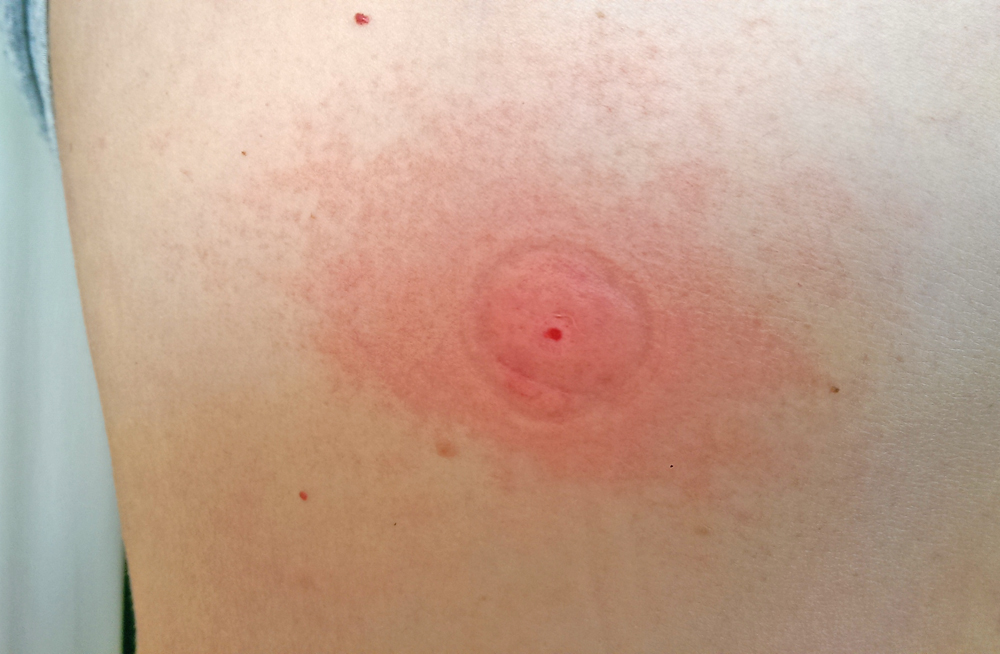 Sawyer The Extractor Pump Kit Extractor 10