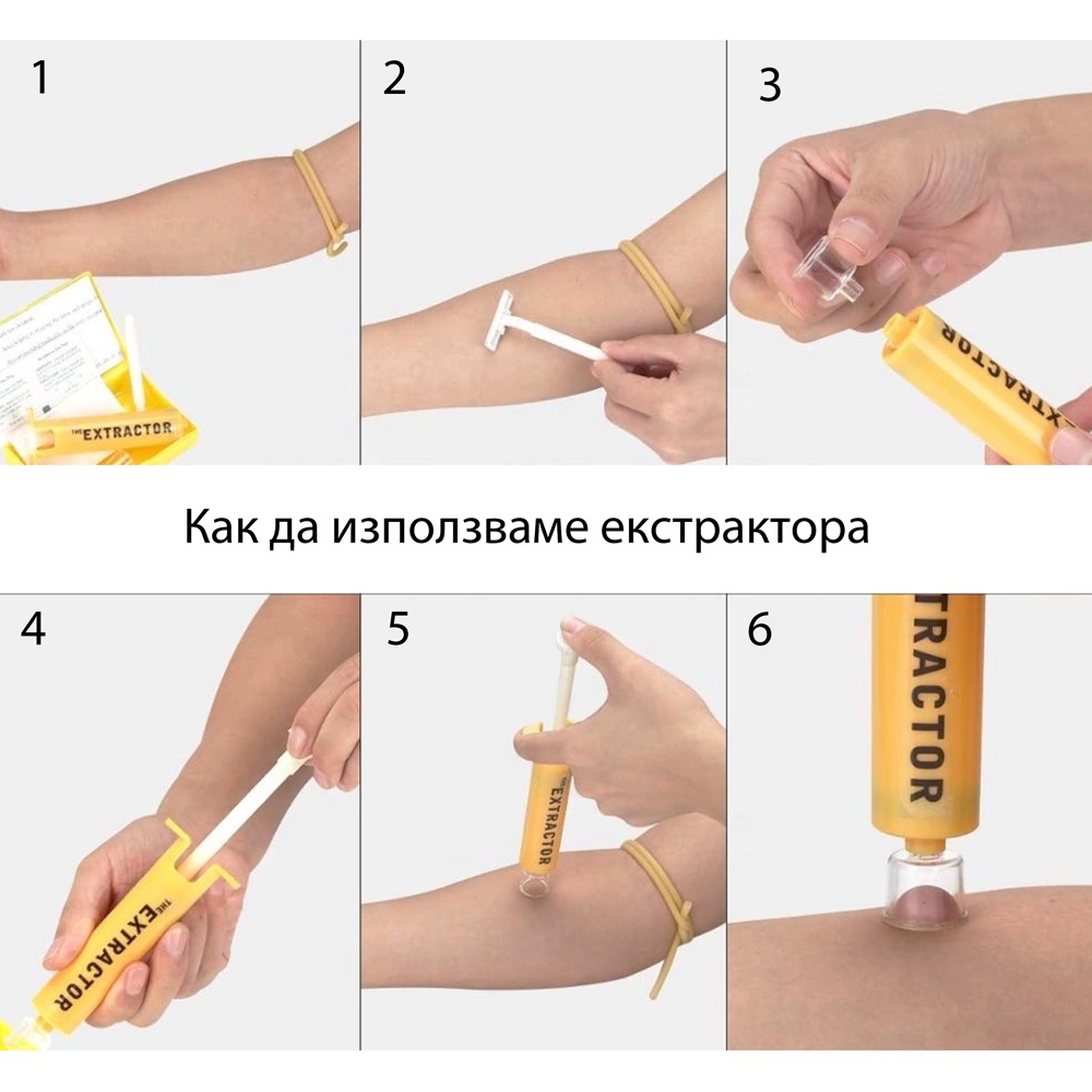 EXTRACTOR PUMP - Extractor Pump Kit for Venom Extraction 5