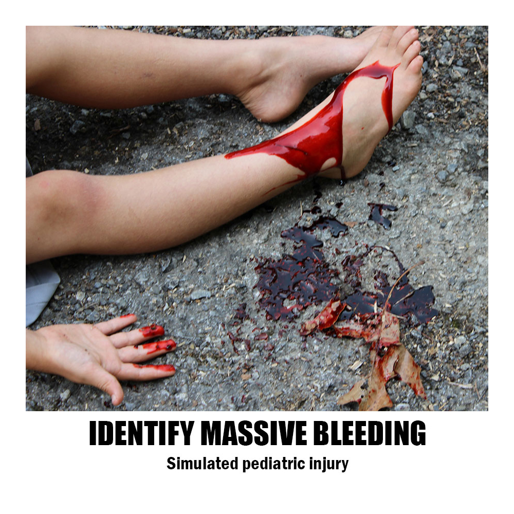 SWAT-T Tourniquet Orange 3